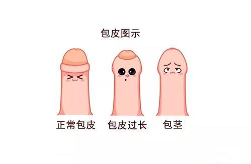 孩子包茎手术视频,专业视频带你了解手术全过程